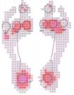 Diabetic feet pressure measurement